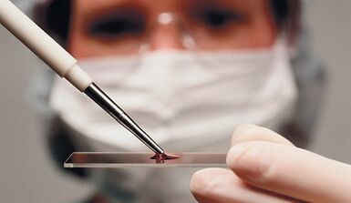 Diagnostic différentiel de l'attribut et de l'arthrose