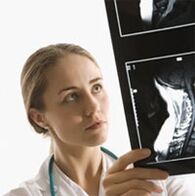 Le diagnostic d'ostéochondrose est spécifié à l'aide d'un examen de faisceau X